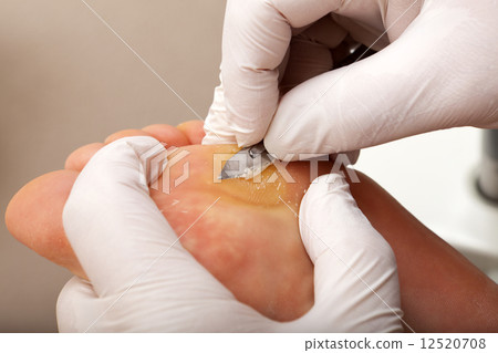 Scrape off dry Skin Scrape off dry Skin 12520708