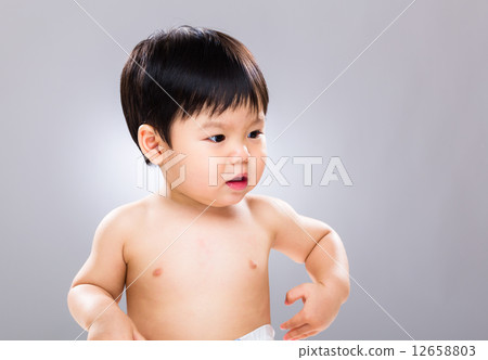 Baby boy scratch his body 12658803