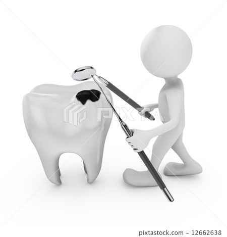 tooth decay tooth decay 12662638