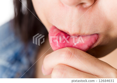 Woman with aphthous stomatitis Woman with aphthous stomatitis 12684631