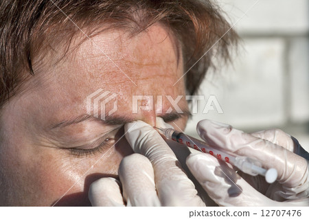 Botox injection 12707476