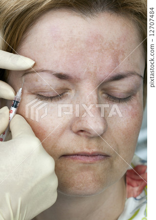 Botox injection Botox injection 12707484