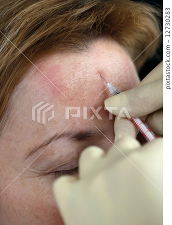 Botox injection 12730283