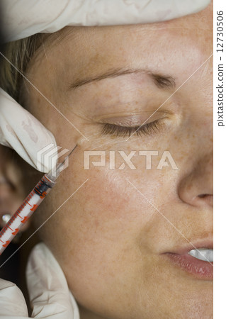 Botox injection in the eye 12730506