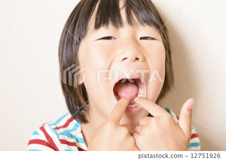 拉直牙齒的女孩 12751926