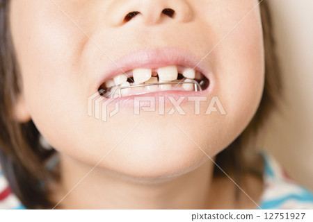 Girls who straighten teeth 12751927