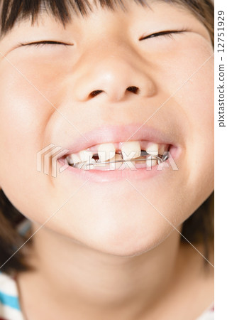 Girls who straighten teeth 12751929