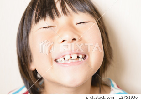 Girls who straighten teeth 12751930