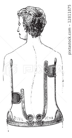 A gear unit against scoliosis, vintage engraving A gear unit against scoliosis, vintage engraving 12811875