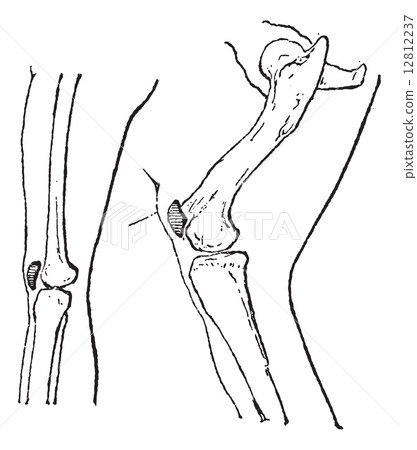 Kneecap or Patella, vintage engraving. 12812237