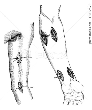 Fig. 760. - Showing the different points at which the arm can be 12812579