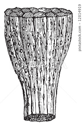 Trichinosis, vintage engraving 12814919