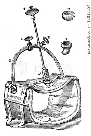 Nelaton compressor to the aorta, vintage engraving. Nelaton compressor to the aorta, vintage engraving. 12815154