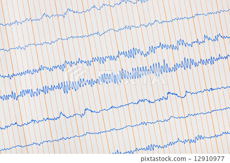 Electrocardiogram ecg 12910977