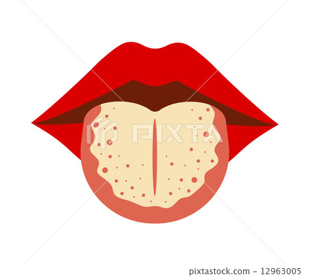Tongue tongue 12963005