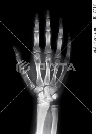 Human hand Human hand 13067717