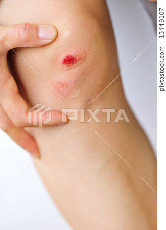 sports injured knee sports injured knee 13449107