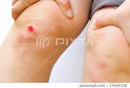 sports injured knee  13449108