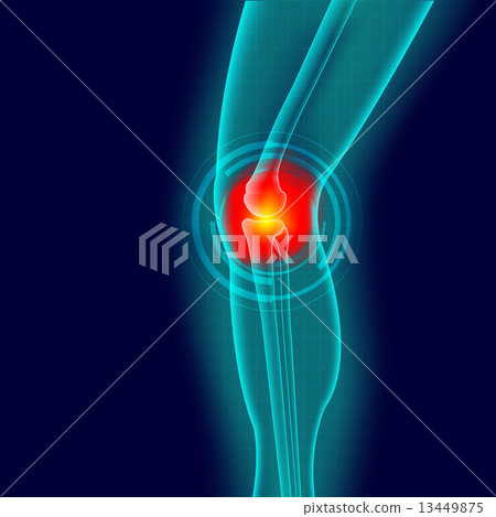 Kneee pain Kneee pain 13449875