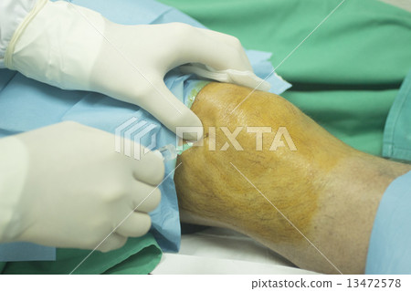 Surgeon and male patient injection human growth factors 13472578