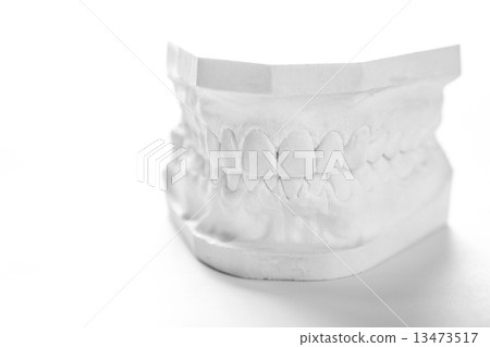 Gypsum model of human jaw on a white background. Gypsum model of human jaw on a white background. 13473517