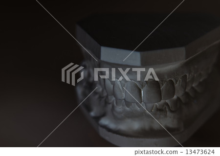 Gypsum model of human jaw on a white background. Gypsum model of human jaw on a white background. 13473624