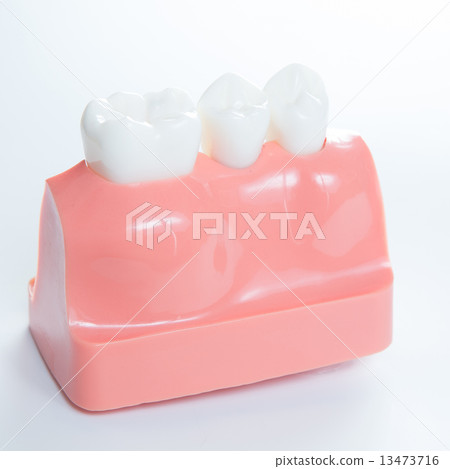Close up of a Dental  implant model.  13473716
