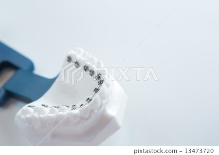 Dental lower jaw bracket braces model on white Dental lower jaw bracket braces model on white 13473720