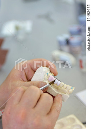 Dentist showing dental cast 13492685