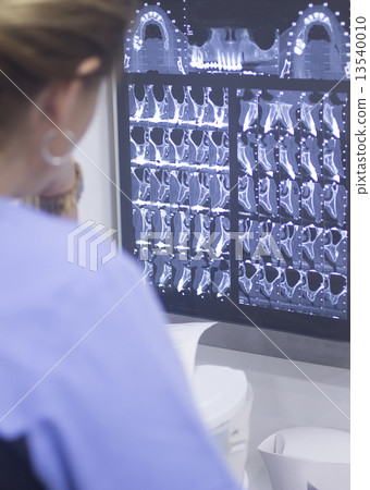 Dental xray scan on viewer in dentist clinic 13540010