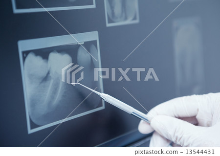 Gloved hand holding dental tool to teeth x-ray Gloved hand holding dental tool to teeth x-ray 13544431