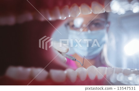 Close up of a mouth open with the dentist behind 13547531
