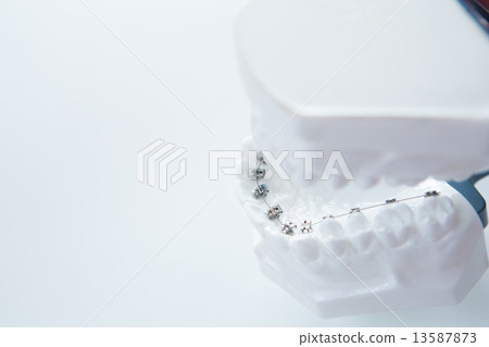 Dental lower jaw bracket braces model on white 13587873