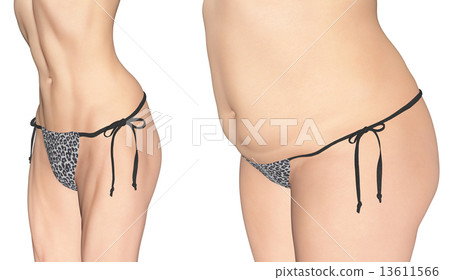  Real 3D CG illustration material before and after dieting 13611566