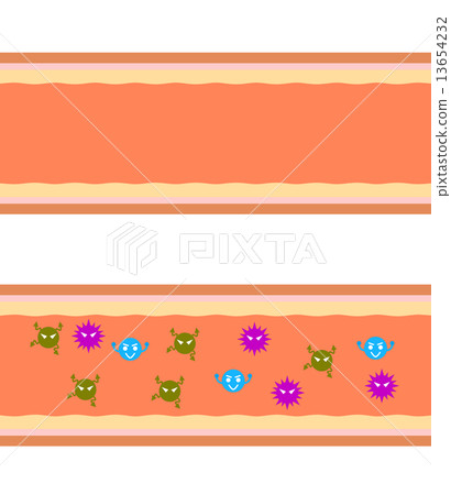 血管中的細菌 13654232