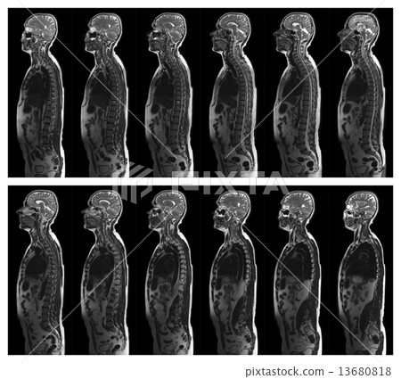 MRI scan 13680818