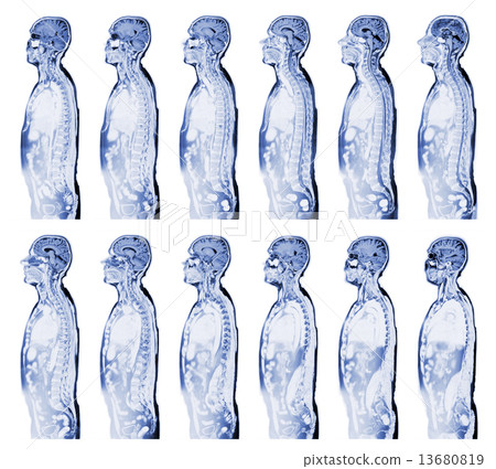 MRI scan 13680819
