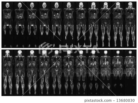 Scan the human body 13680830