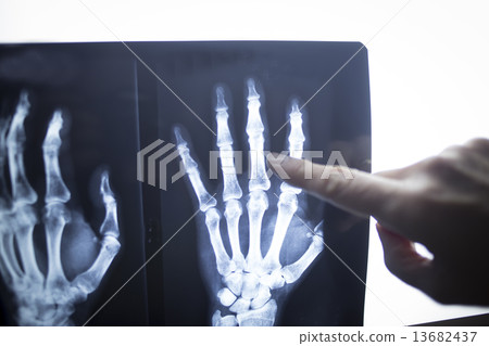 Medical doctor pointing at radiograph x-ray image 13682437