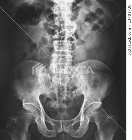 X-ray of the pelvis and spinal column 13781736