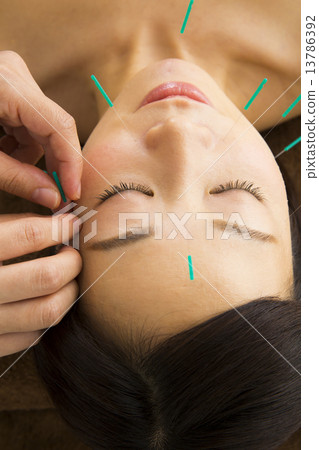 Beauty Acupuncture 13786392
