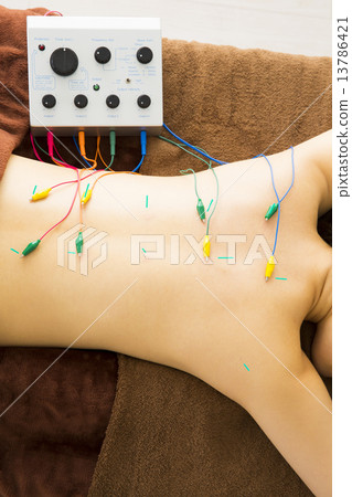 Acupuncture treatment Acupuncture treatment 13786421
