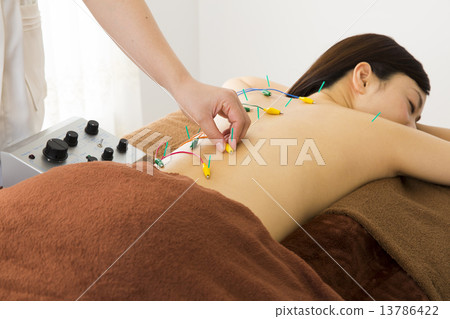 Acupuncture treatment Acupuncture treatment 13786422