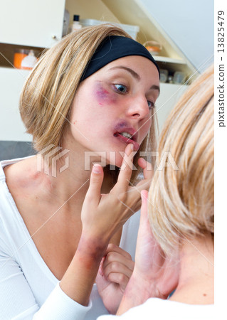 woman covered with bruises in front of the mirror woman covered with bruises in front of the mirror 13825479