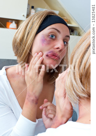 woman covered with bruises in front of the mirror woman covered with bruises in front of the mirror 13825481