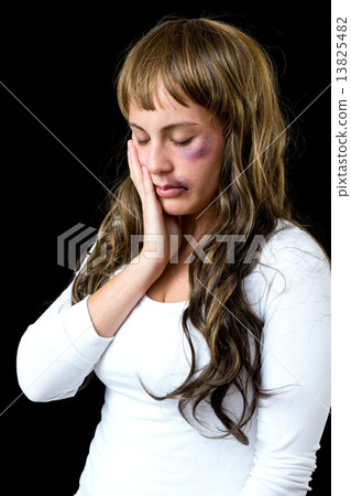 woman with bruises 13825482