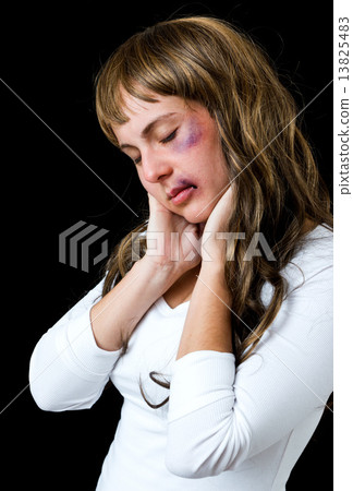 woman with bruises woman with bruises 13825483
