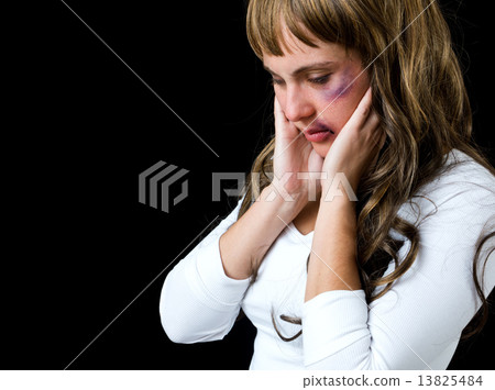 woman with bruises 13825484