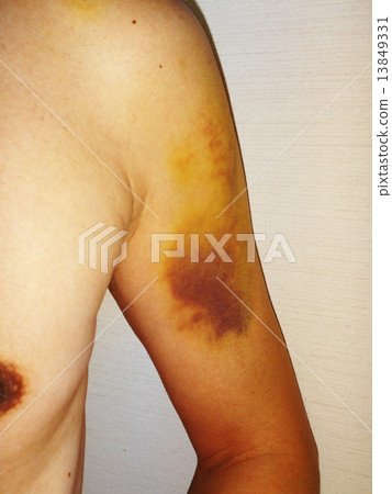 Arm Of The Arm 2 Arm Of The Arm 2 13849331