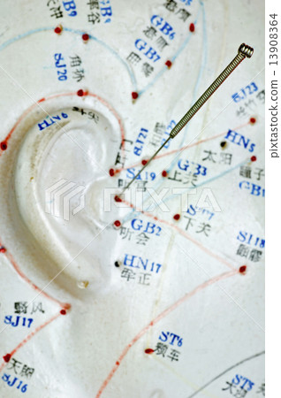 Acupuncture needle on head model 13908364